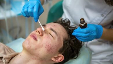 Acne Scar Treatment in Mumbai
