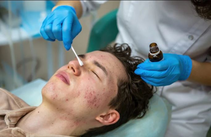 Acne Scar Treatment in Mumbai