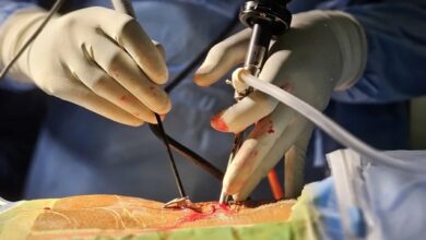 Best Spine Surgeon in Kerala