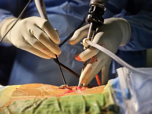 Best Spine Surgeon in Kerala