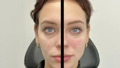 Best treatments for your skin Chicago