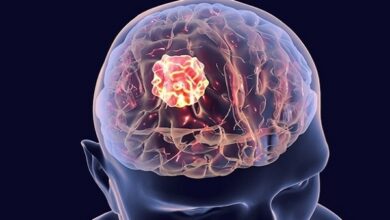 Brain Tumor Treatment Cost in India