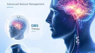 Best Neurologist for Epilepsy in India
