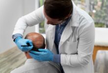 Hair Transplant Chicago
