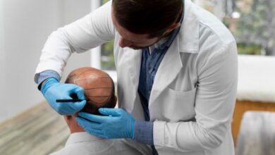 Hair Transplant Chicago