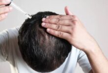 Gfc Hair Treatment​